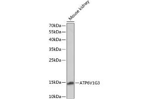 Western Blotting (WB) image for anti-ATPase, H+ Transporting, Lysosomal 13kDa, V1 Subunit G3 (ATP6V1G3) (AA 1-118) antibody (ABIN7265759)
