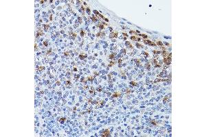 Immunohistochemistry of paraffin-embedded human tonsil using GPR109A/HM74A/HC Rabbit pAb (ABIN7267804) at dilution of 1:25 (40x lens). (HCAR2 Antikörper  (AA 250-350))