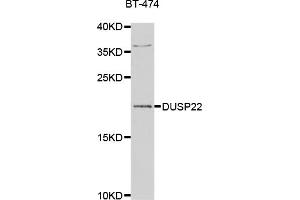 Western blot analysis of extracts of BT-474 cells, using DUSP22 antibody. (DUSP22 Antikörper)