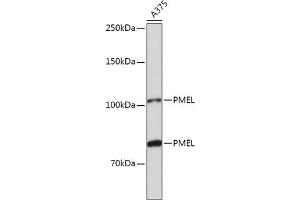 Western blot analysis of extracts of  cells, using PMEL antibody (ABIN7269510) at 1:1000 dilution. (Melanoma gp100 Antikörper  (AA 25-300))
