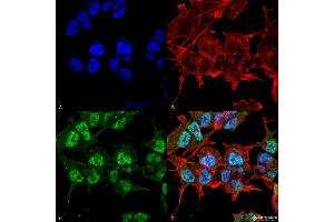 Immunocytochemistry/Immunofluorescence analysis using Mouse Anti-GABA-A Receptor Alpha2 Monoclonal Antibody, Clone S399-19 . (GABRA1 Antikörper  (AA 350-385))