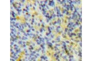 IHC-P analysis of Spleen tissue, with DAB staining. (SOCS3 Antikörper  (AA 1-225))
