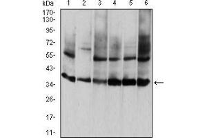 Western blot analysis using ANXA5 mouse mAb against HepG2 (1), PNAC-1 (2), NIH/3T3 (3), Hela (4), MCF-7 (5), and A431 (6) cell lysate. (Annexin V Antikörper  (AA 160-320))