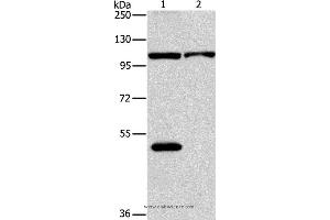 Western blot analysis of K562 and hela cell, using NLRP3 Polyclonal Antibody at dilution of 1:88 (NLRP3 Antikörper)