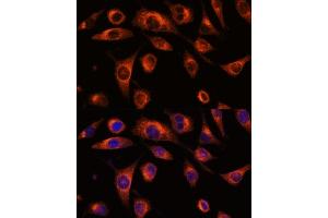 Immunofluorescence analysis of L929 cells using SC antibody (ABIN7270188) at dilution of 1:100. (SCAMP2 Antikörper  (AA 1-152))