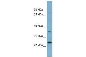 WB Suggested Anti-NOSIP  Antibody Titration: 0. (NOSIP Antikörper  (N-Term))