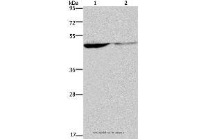 Western blot analysis of Human paraneoplastic and normal kidney tissue, using KCNK9 Polyclonal Antibody at dilution of 1:650 (KCNK9 Antikörper)