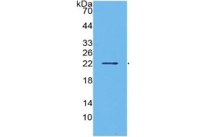 WB of Protein Standard: different control antibodies  against Highly purified E.