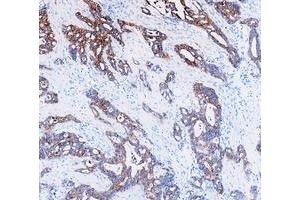 IHC analysis of Cytokeratin 8/KRT8 using anti-Cytokeratin 8/KRT8 antibody (ABIN5518853). (KRT8 Antikörper  (AA 107-325))