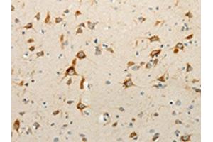 The image on the left is immunohistochemistry of paraffin-embedded Human brain tissue using ABIN7130917(RPAP3 Antibody) at dilution 1/15, on the right is treated with fusion protein. (RPAP3 Antikörper)