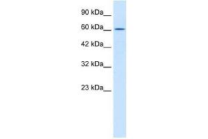 TRIM17 antibody used at 2. (TRIM17 / RNF16 Antikörper  (Middle Region))