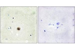 Immunohistochemistry analysis of paraffin-embedded human brain tissue, using CRP1 Antibody. (CSRP1 Antikörper  (AA 51-100))