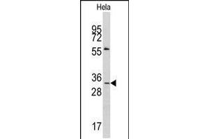 Western blot analysis of anti-MAGEA1 Antibody in Hela cell line lysates (35ug/lane). (MAGEA1 Antikörper  (AA 143-173))