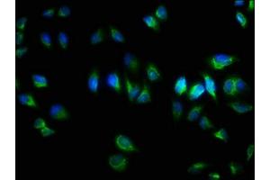 Immunofluorescence staining of Hela cells with  at 1:333, counter-stained with DAPI. (TNRC6A Antikörper  (AA 1-161))