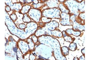 Formalin-fixed, paraffin-embedded human Placenta stained with CD71 Mouse Monoclonal Antibody (TFRC/1817). (Transferrin Receptor Antikörper  (AA 94-212))