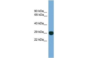 WB Suggested Anti-EIF4E2  Antibody Titration: 0. (EIF4E2 Antikörper  (N-Term))