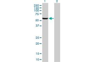 Western Blot analysis of GHDC expression in transfected 293T cell line by GHDC MaxPab polyclonal antibody. (GHDC Antikörper  (AA 1-530))