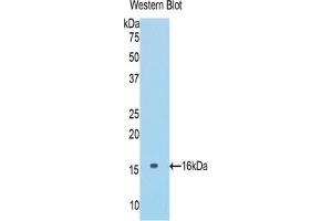 Western blot analysis of the recombinant protein. (COL6A1 Antikörper  (AA 82-212))