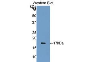 Western blot analysis of the recombinant protein. (ADAMTS1 Antikörper  (AA 476-614))