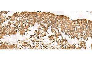 Immunohistochemistry (Paraffin-embedded Sections) (IHC (p)) image for anti-Proteasome Subunit Alpha Type 3 (PSMA3) antibody (ABIN7246538)