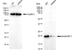Western blotting analysis using presenilin 1 antibody (ABIN7799897). (Rekombinanter Presenilin 1 Antikörper)