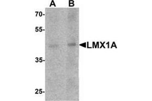 Western blot analysis of LMX1A in rat brain tissue lysaet with LMX1A Antibody  at (A) 1 and (B) 2 μg/ml.