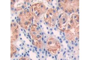 Used in DAB staining on fromalin fixed paraffin- embedded Kidney tissue (DGKG Antikörper  (AA 346-576))