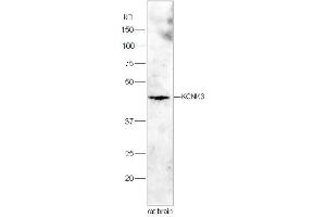 Lane 1:Rat brain lysates probed with Rabbit Anti-KCNK3 Polyclonal Antibody, Unconjugated  at 1:3000 for 90 min at 37˚C.