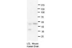 Western Blotting (WB) image for anti-Protein Arginine Methyltransferase 2 (PRMT2) (N-Term) antibody (ABIN2778663)