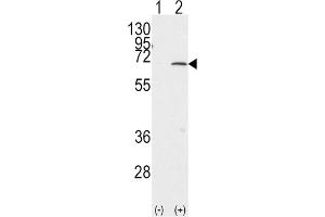 Western Blotting (WB) image for anti-Protein Inhibitor of Activated STAT, 1 (PIAS1) antibody (ABIN2996746) (PIAS1 Antikörper)