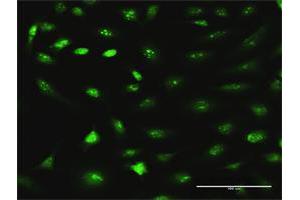 Immunofluorescence (IF) image for anti-RRS1 Ribosome Biogenesis Regulator (RRS1) (AA 1-365) antibody (ABIN949091)