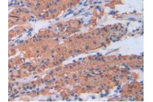 IHC-P analysis of Human Stomach Tissue, with DAB staining. (CRP Antikörper  (AA 17-224))