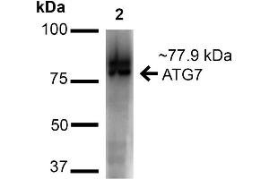 Western blot analysis of Human Cervical Cancer cell lysates (HeLa) showing detection of ~77. (ATG7 Antikörper  (N-Term) (HRP))