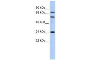 Image no. 1 for anti-Structure Specific Recognition Protein 1 (SSRP1) (AA 503-552) antibody (ABIN6742197) (SSRP1 Antikörper  (AA 503-552))