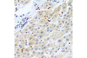 Immunohistochemistry of paraffin-embedded human liver using RGS5 antibody. (RGS5 Antikörper)