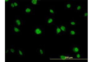 Image no. 4 for anti-V-Akt Murine Thymoma Viral Oncogene Homolog 1 (AKT1) (AA 1-481) antibody (ABIN598531) (AKT1 Antikörper  (AA 1-481))