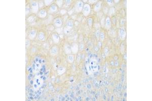 Immunohistochemistry of paraffin-embedded human esophagus using CDH1 antibody (ABIN5997408) at dilution of 1/100 (40x lens). (E-cadherin Antikörper)