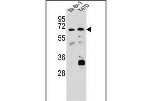 CES8 Antibody (C-term) (ABIN656888 and ABIN2846087) western blot analysis in Sk-Br-3,T47D cell line lysates (35 μg/lane). (CES4A Antikörper  (C-Term))