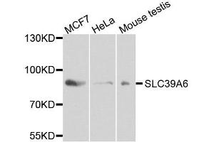 Western blot analysis of extracts of various cell lines, using SLC39A6 antibody. (SLC39A6 Antikörper  (AA 170-320))