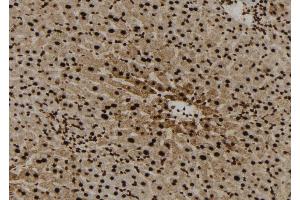 ABIN6272959 at 1/100 staining Mouse liver tissue by IHC-P. (FABP5 Antikörper  (Internal Region))
