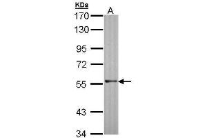 WB Image Sample (30 ug of whole cell lysate) A: Molt-4 , 7. (RAG2 Antikörper  (Center))