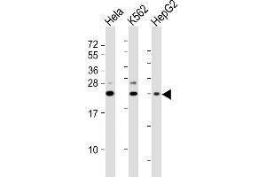 All lanes : Anti-SRY Antibody (N-Term) at 1:2000 dilution Lane 1: Hela whole cell lysates Lane 2: K562 whole cell lysates Lane 3: HepG2 whole cell lysates Lysates/proteins at 20 μg per lane. (SRY Antikörper  (AA 52-82))