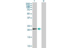Western Blot analysis of N6AMT1 expression in transfected 293T cell line by N6AMT1 MaxPab polyclonal antibody. (N6AMT1 Antikörper  (AA 1-186))