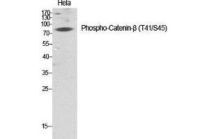 Western Blot (WB) analysis of specific cells using Phospho-Catenin-beta (T41/S45) Polyclonal Antibody. (beta Catenin Antikörper  (pSer45, pThr41))
