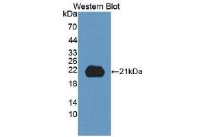 Detection of Recombinant ITGb8, Human using Polyclonal Antibody to Integrin Beta 8 (ITGb8) (ITGB8 Antikörper  (AA 471-629))