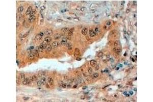 AP23772PU-N SEMA3E antibody staining of Paraffin Embedded Human Prostate at 4 µg/ml.