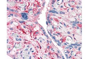 Anti-CD26 antibody IHC of human placenta. (DPP4 Antikörper  (Internal Region))