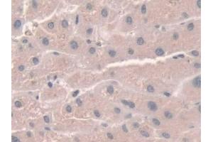 Detection of NOX1 in Human Liver Tissue using Polyclonal Antibody to Nicotinamide Adenine Dinucleotide Phosphate Oxidase 1 (NOX1) (NOX1 Antikörper  (AA 235-488))