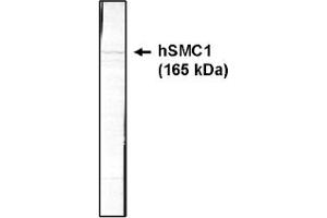 Western Blotting (WB) image for anti-Structural Maintenance of Chromosomes 1A (SMC1A) (AA 402-894) antibody (ABIN264420) (SMC1A Antikörper  (AA 402-894))