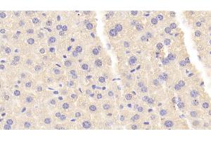 Detection of CARNS1 in Mouse Liver Tissue using Polyclonal Antibody to Carnosine Synthase 1 (CARNS1) (CARNS1 Antikörper  (AA 623-826))